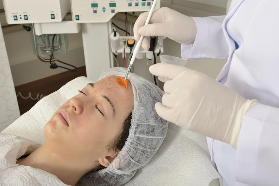 Facial Peel Treatment